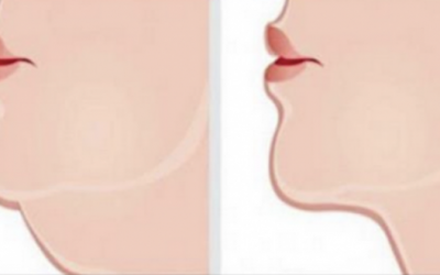 The Easiest Way To Deal With That Double Chin