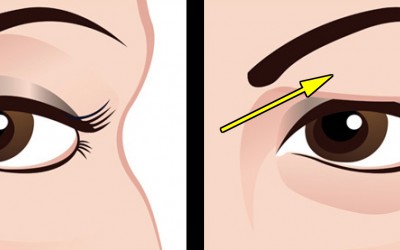 If You Get Droopy Eyelids THIS Is The Most Natural and Effective Way To Treat It. I Had No Idea