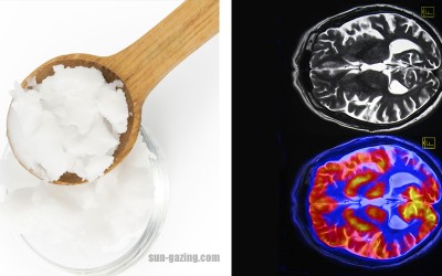 The Major Health Benefits Of Consuming Coconut Oil Daily