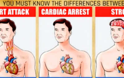 How To Tell If You Are Having a Stroke, Cardiac Arrest or a Heart Attack.