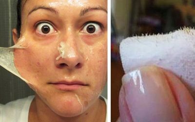 With Only 2 Ingredients She Reveals How You Can Make Your Own Blackhead Strips!