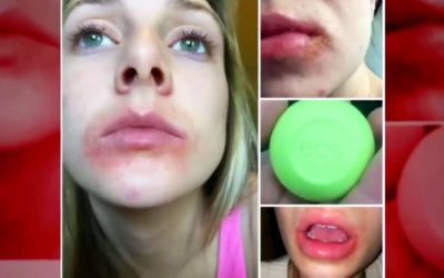 If You Use This Popular Lip Balm Stop Right NOW! The Reason Is Scary!