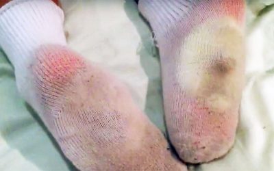 Her Daughter Had A Fever That Wouldn’t Go Away. But After She Put THIS In Her Sock And The Fever Broke!