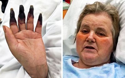 A Healthy Woman Was Cleaning Her House For 2 Hours. Then She Noticed Her Hands and Fingers Turned Dark Black!