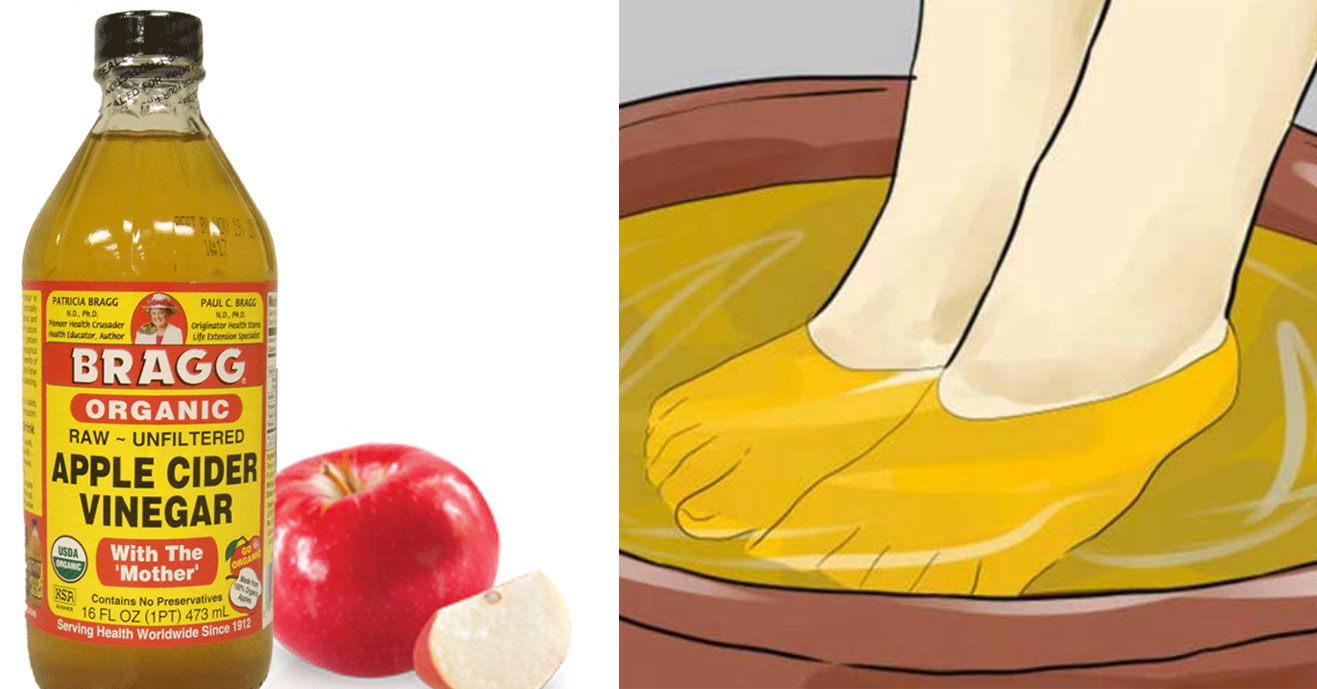 she-puts-her-feet-in-apple-cider-vinegar-for-30-minutes-a-day-for-a