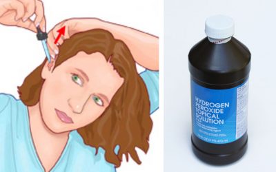 She Drops Hydrogen Peroxide In Her Ears 3x Per Week For a Month. The Reason Is Unexpectedly GENIUS!