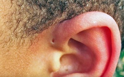 Have You Ever Spotted THIS Small Hole Above Someone’s Ear? THIS Is The Strange Reason Why It’s There!