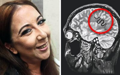 Her Doctors Thought She Had a Brain Tumor. But When The Surgeons Open Her Up They Discover Something Terrifying!