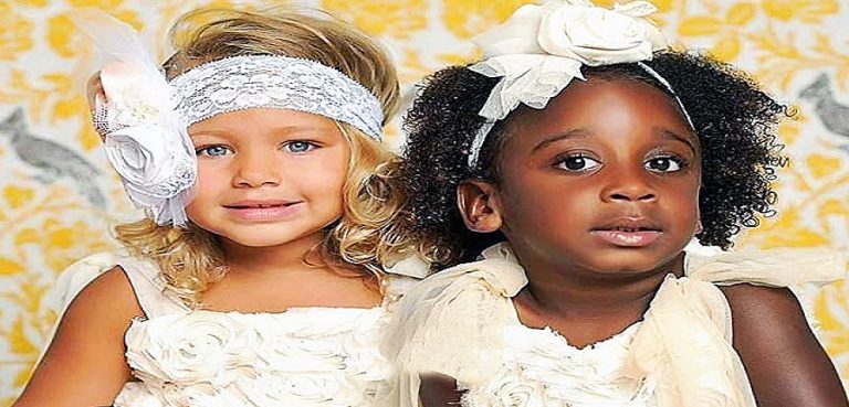 Mother's Twin Babies Were Somehow Born Different Colors! 20 Years Later ...