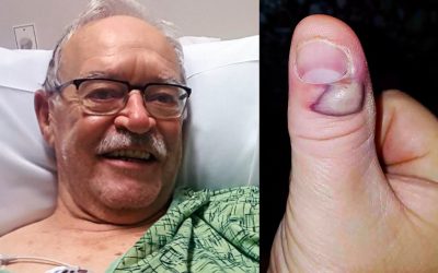 Grandpa Was Biting His Fingernails But Now He’s In Critical Condition In a Fight For His Life With Sepsis!